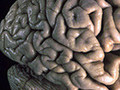 Human Brain Project: un an après