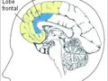 Anomalie cérébrale particulière chez les rares schizophrènes ayant des antécédents de violence