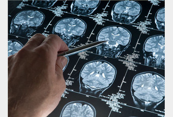 Cerveau