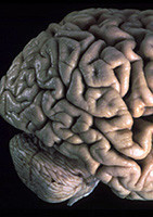 Brain-B.
