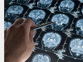 On peut décrypter les émotions dans le cerveau